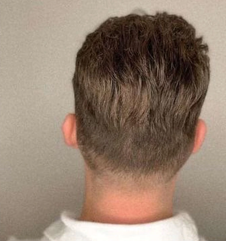 After: same rear view showing styled, fuller-looking hair