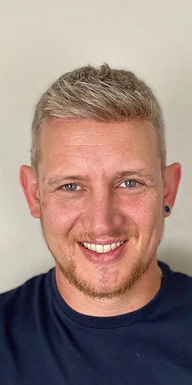 After: a short styled look with fuller front hairline